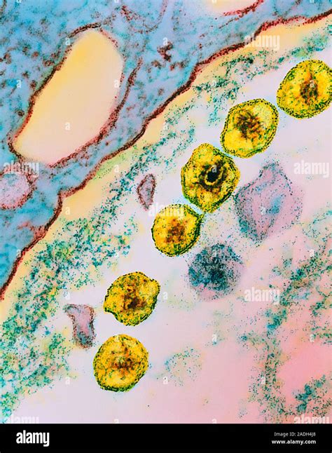 simenteryo viral|Simian immunodeficiency virus .